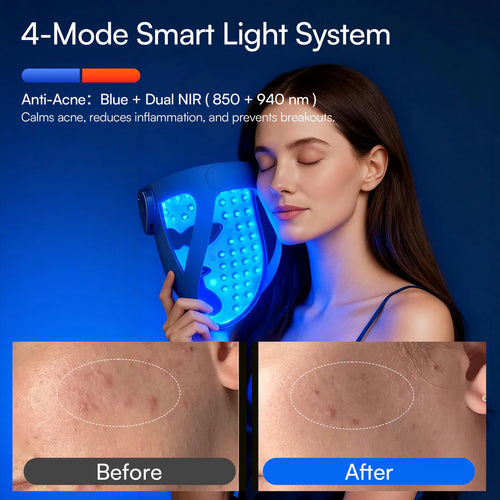 940 NM Red-Light Therapy Mask